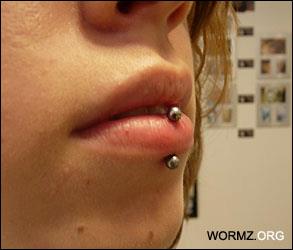 Vertical labret lävistys