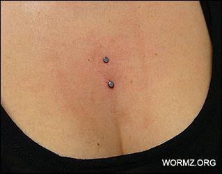 Cleavage lävistys